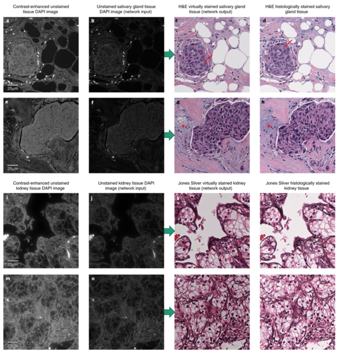 Un algorithme de deep learning pour optimiser le processus de coloration des tissus utilisé en histopathologie