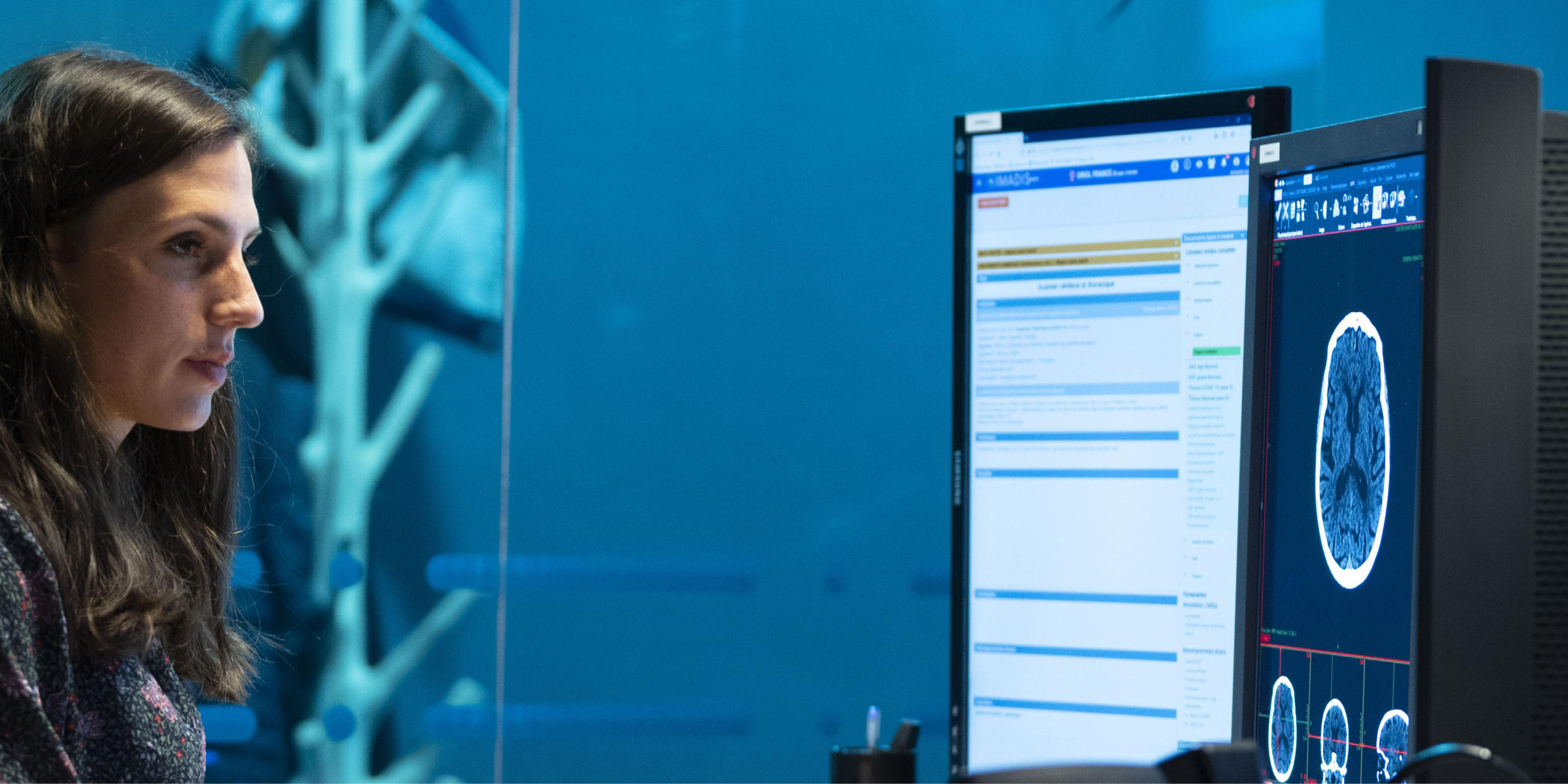 IMADIS: Artificial Intelligence for teleradiology in emergency services