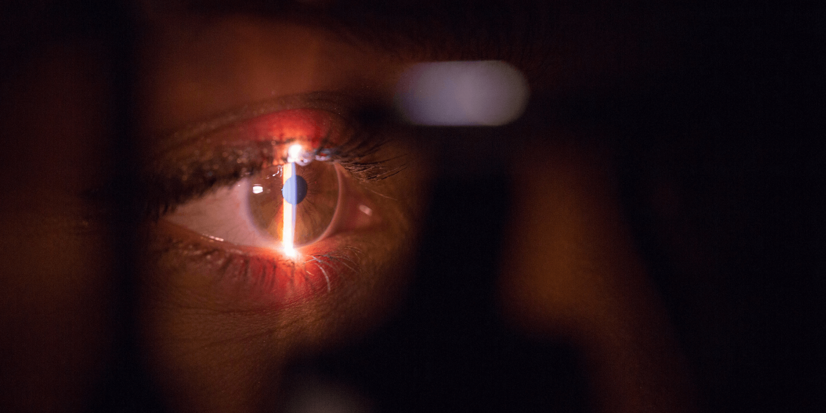 Canada: A look back at the partnership between the Centre Hospitalier de Montréal and DIAGNOS for diabetic retinopathy screening