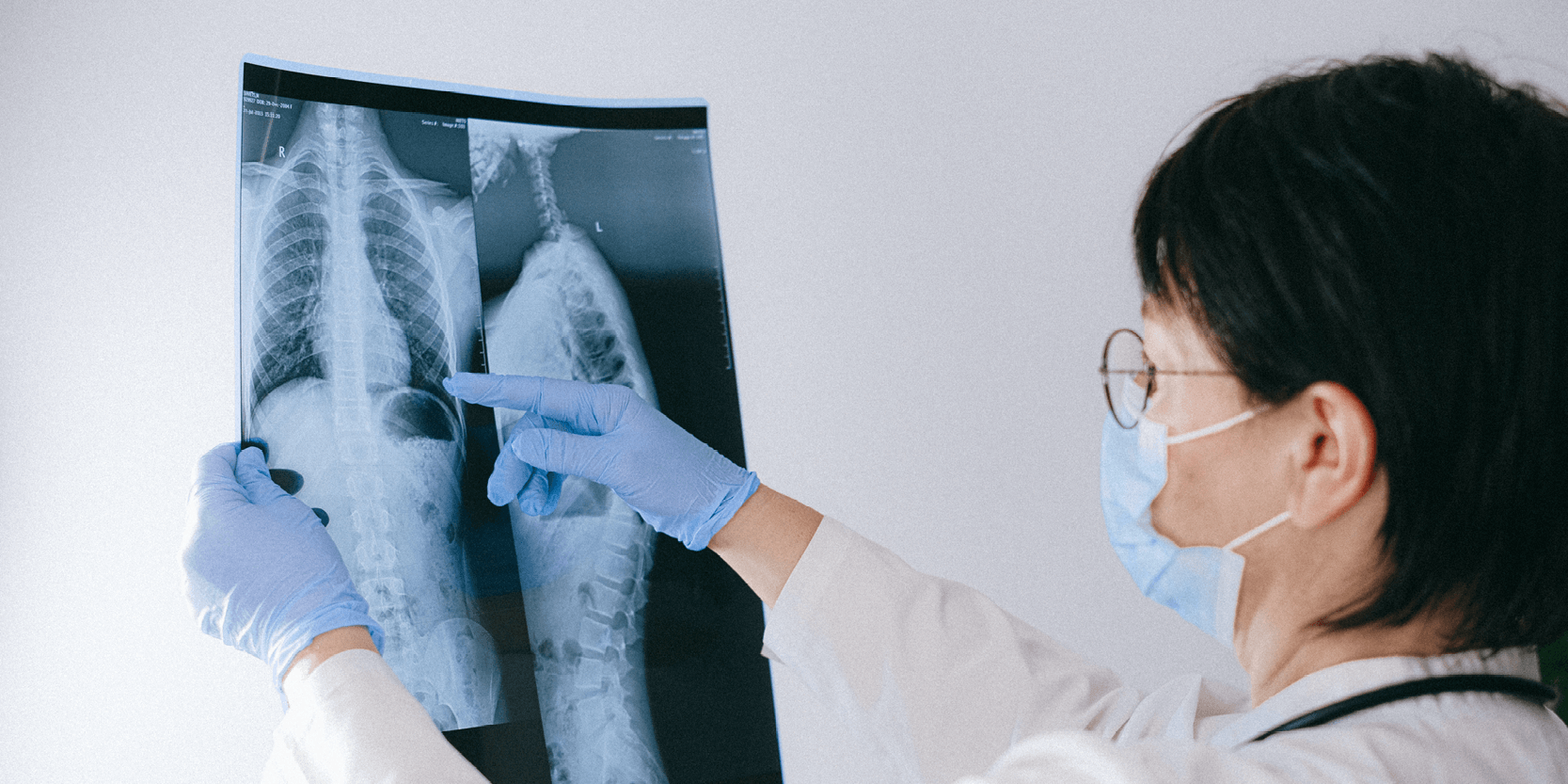 Deep learning could help detect TB earlier in low-income countries