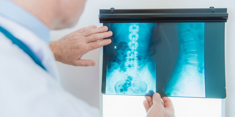 Incepto et Stephanix s'associent pour intégrer des solutions innovantes d'IA à l'imagerie médicale