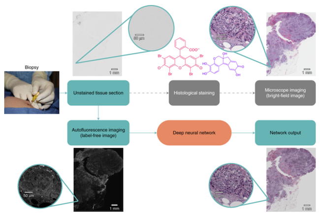 UCLA histopathologie 1