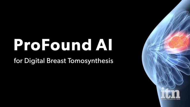 iCAD lance la solution ProFound AI™ 2D pour la mammographie en Europe