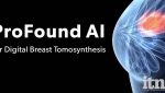 ProFound AI