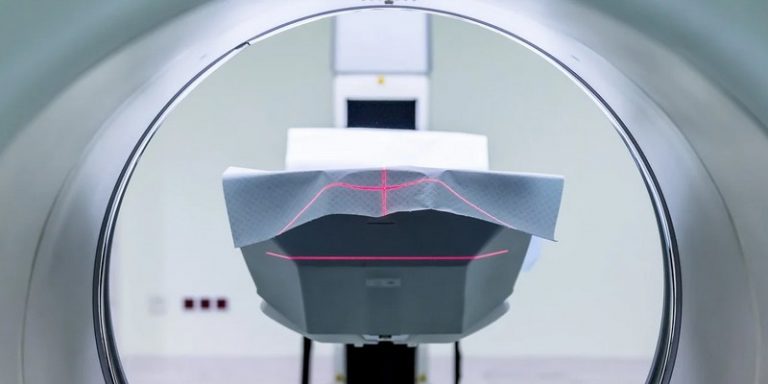 Le Centre Léon Bérard va piloter trois projets utilisant l’IA pour améliorer les radiothérapies