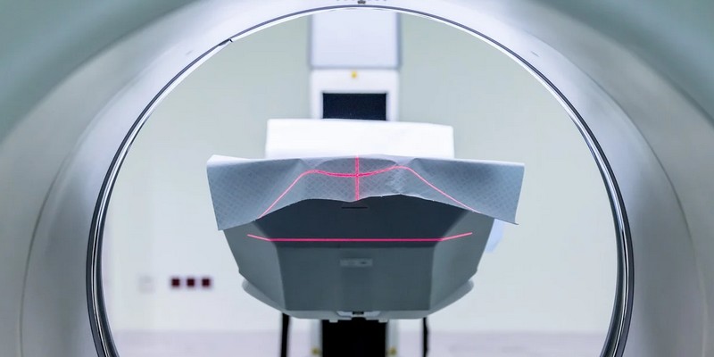 Le Centre Léon Bérard va lancer trois projets pour améliorer le suivi des traitements du cancer et utilisant l'IA