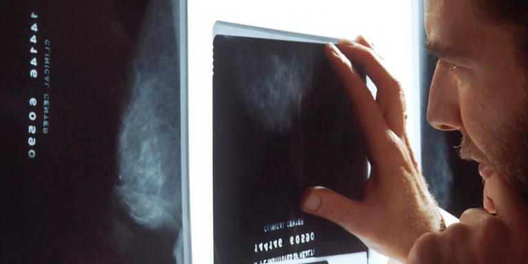 L’American College of Radiology publie une enquête sur les usages de l’intelligence artificielle en radiologie