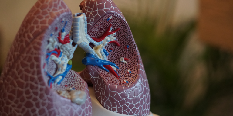 University at Buffalo researchers identify key drivers of lung cancer using AI