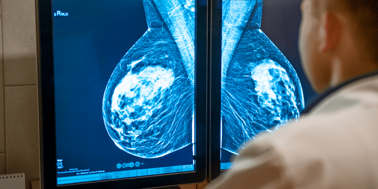 L’Institut Curie publie les résultats de la solution Galen Breast d’Ibex Medical Analytics